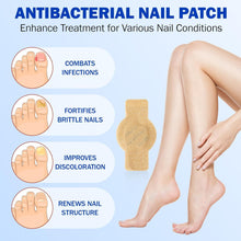 Load image into Gallery viewer, NailHeal - Fungal Nail Patches šæš
( Buy 1 Get 1 Freeš„š„)