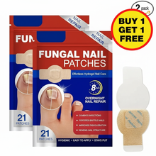 Load image into Gallery viewer, NailHeal - Fungal Nail Patches 🌿💅 ( Buy 1 Get 1 Free🔥🔥)
